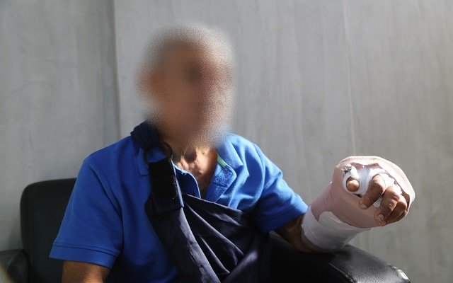 Paciente con buen diagnóstico tras reconstrucción de mano en el Gautier 