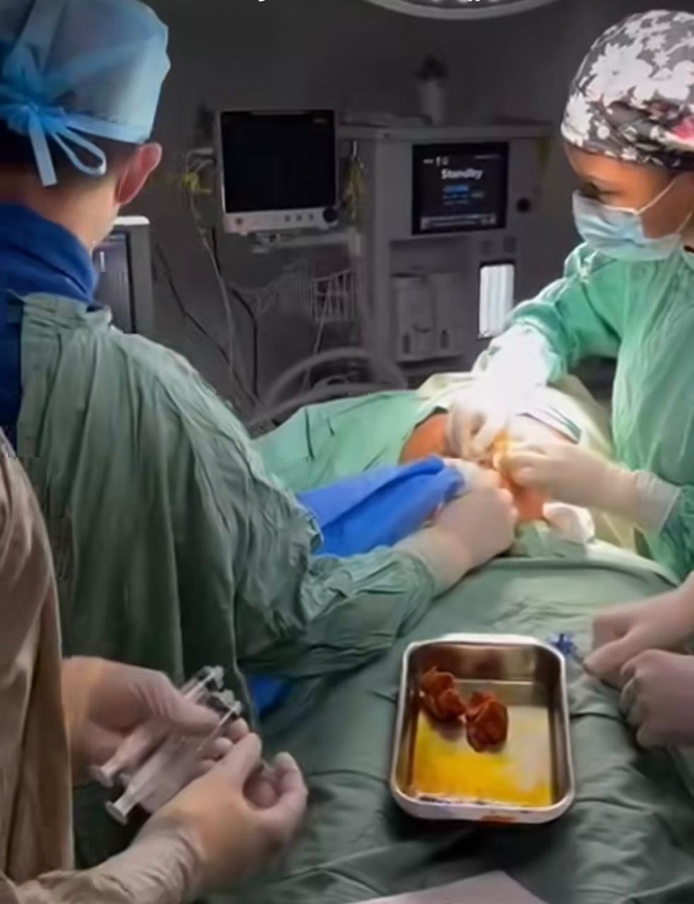 Hospital de la Mujer realiza primer procedimiento de Amniodrenaje