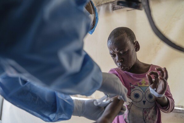 La ONU autoriza la primera vacuna infantil contra la viruela símica en el Congo