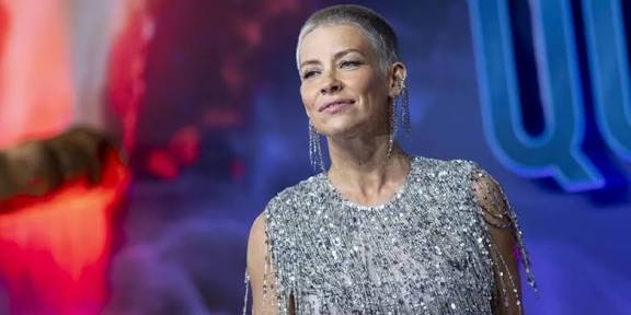 La actriz Evangeline Lilly anuncia que tiene daño cerebral