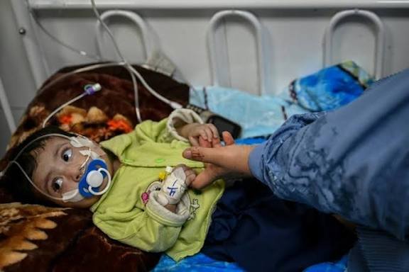 En Afganistán, un hospital es la última esperanza para madres de niños con desnutrición