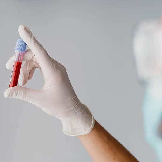 Un nuevo método avanza hacia la detección del cáncer con un análisis de sangre