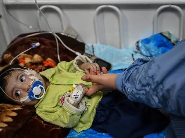 Un millón de niños podrían morir de desnutrición en Afganistán, alerta Unicef